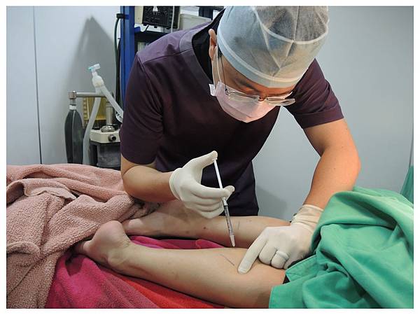 台中自體脂肪豐頰臉部補脂台中菲仕美