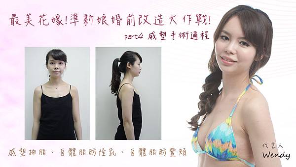 台中抽脂隆乳自體脂肪隆乳菲仕美 台中抽脂隆乳自體脂肪隆乳菲仕美