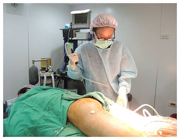 台中抽脂隆乳自體脂肪隆乳菲仕美 台中抽脂隆乳自體脂肪隆乳菲仕美