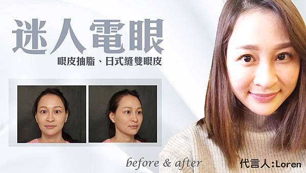 旖倫雙眼皮banner.jpg 旖倫雙眼皮banner.jpg