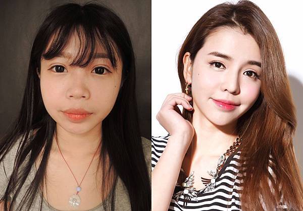 台中墊下巴手術|台中下巴整形|菲仕美診所 台中墊下巴手術|台中下巴整形|菲仕美診所