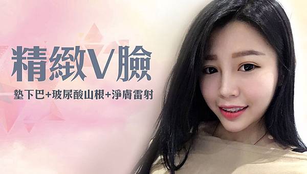 台中墊下巴手術|台中下巴整形|菲仕美診所 台中墊下巴手術|台中下巴整形|菲仕美診所