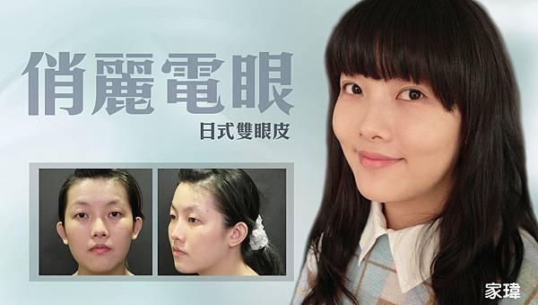 台中縫雙眼皮診所|台中雙眼皮|菲仕美診所 台中縫雙眼皮診所|台中雙眼皮|菲仕美診所