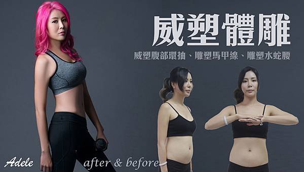 台中抽脂手術威塑抽脂體雕台中菲仕美 台中抽脂手術威塑抽脂體雕台中菲仕美