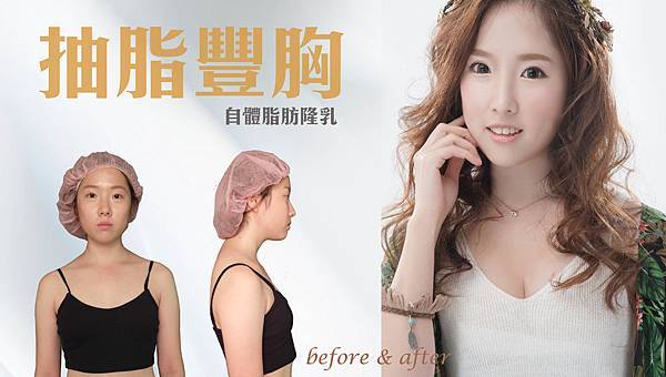 台中自體脂肪隆乳抽脂補胸推薦台中菲仕美 台中自體脂肪隆乳抽脂補胸推薦台中菲仕美