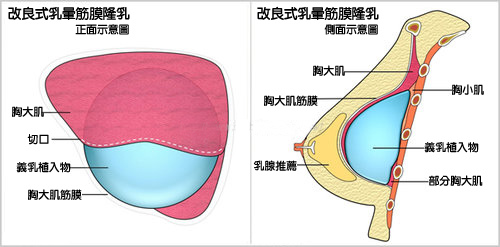 台中隆乳手術、台中自體脂肪隆乳、台中隆乳費用價格、台中水滴型(形)果凍隆乳、台中內視鏡隆乳、台中果凍矽膠豐胸隆乳、台中蜜桃絨隆乳、台中乳暈隆乳、台中豐胸、台中腋下隆乳、台中肚臍隆乳、台中筋膜下隆乳、台中自體移植脂肪隆乳、台中隆乳按摩、台中隆乳術後按摩、台中隆乳價格、台中隆乳價錢、台中隆乳推薦醫師、台中隆乳權威名醫、台中整形外科醫學美容、台中菲仕美診所、台灣隆乳隆胸手術專家，林孟羲院長｜楊學穎醫師｜許永昌醫師｜朱純慧醫師