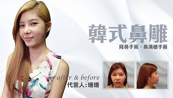 台中結構式隆鼻|台中隆鼻權威|菲仕美楊學穎 台中結構式隆鼻|台中隆鼻權威|菲仕美楊學穎
