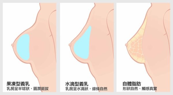 台中隆乳術後按摩｜台中隆乳整形外科權威|菲仕美