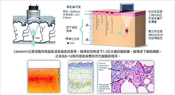 台中立塑溶脂推薦菲仕美朱純慧醫師 台中立塑溶脂推薦菲仕美朱純慧醫師