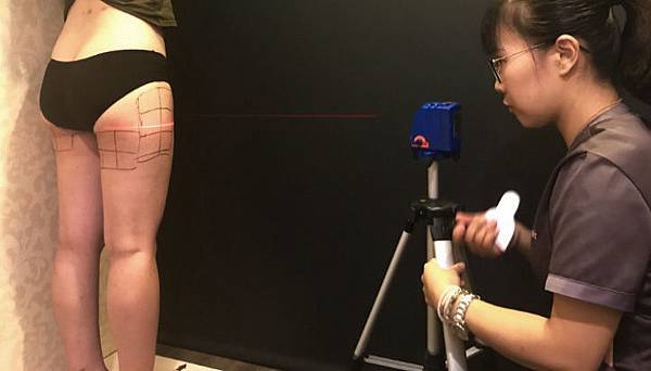 liposonix立塑聚焦音波溶脂價錢 liposonix立塑聚焦音波溶脂價錢