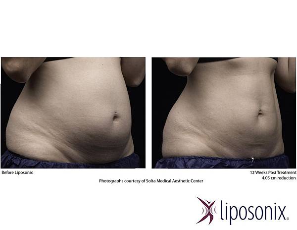 台中立塑溶脂推薦菲仕美整形外科女醫師朱純慧醫師 台中立塑溶脂推薦菲仕美整形外科女醫師朱純慧醫師