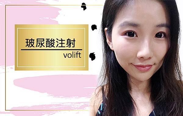 台中玻尿酸豐唇|台中醫美玻尿酸微整|菲仕美診所朱純慧醫師 台中玻尿酸豐唇|台中醫美玻尿酸微整|菲仕美診所朱純慧醫師