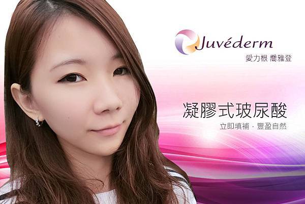 台中打玻尿酸|台中微整推薦診所|台中菲仕美 台中打玻尿酸|台中微整推薦診所|台中菲仕美