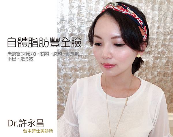 台中自體脂肪豐頰台中菲仕美 自體脂肪補臉 台中自體脂肪豐頰台中菲仕美 自體脂肪補臉