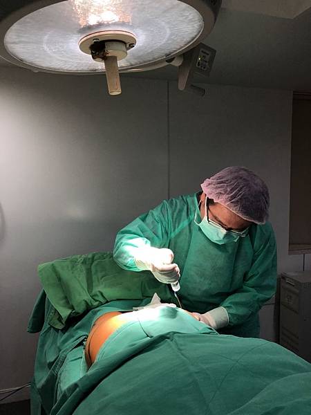 台中自體脂肪豐頰自體脂肪填補蘋果肌 整形外科許永昌醫師