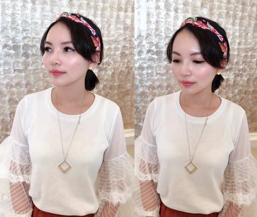 台中自體脂肪豐頰 菲仕美整形外科許永昌醫師 台中自體脂肪豐頰 菲仕美整形外科許永昌醫師