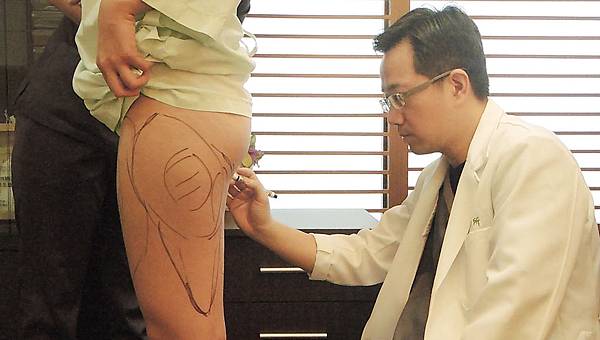 台中威塑抽脂台中抽脂推薦菲仕美診所