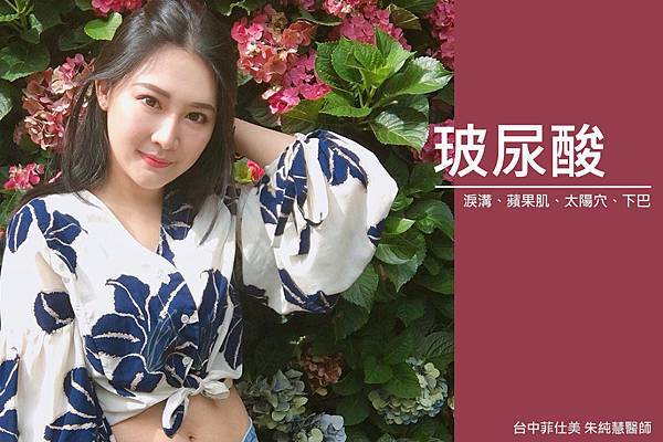台中玻尿酸|台中玻尿酸推薦PTT|台中菲仕美 台中玻尿酸|台中玻尿酸推薦PTT|台中菲仕美