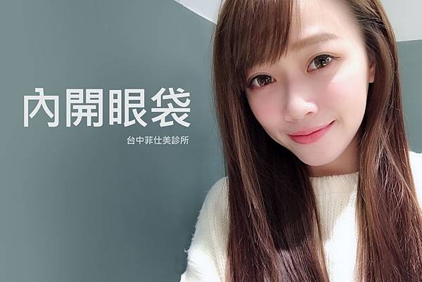 台中眼袋|台中除眼袋|菲仕美 眼袋內開 台中眼袋|台中除眼袋|菲仕美 眼袋內開