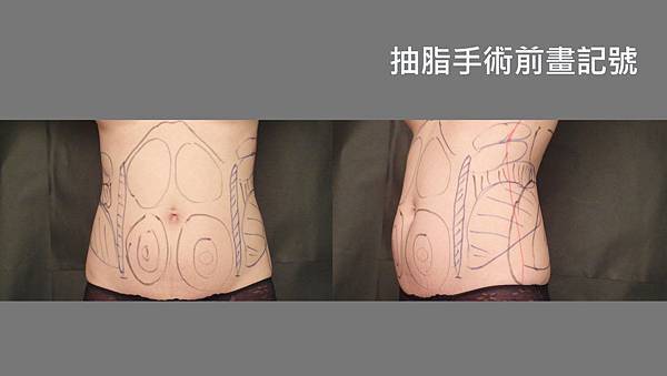 BEFORE2.jpg BEFORE2.jpg