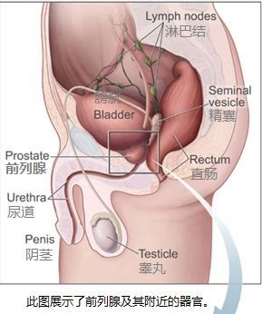 0719-攝護腺 (3).jpg