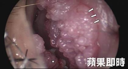 挖鼻孔 數鈔票 菜花朵朵開 草湳里 老頭談性 痞客邦