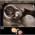 baby#2 21w (4) 大頭照