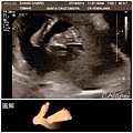 baby#2 21w (5) 可愛的一對小腳丫