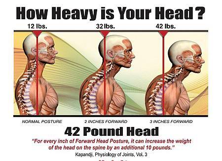Forward-Head.jpg Forward-Head.jpg