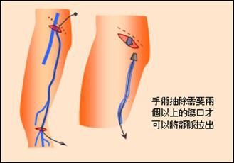 傳統治療9