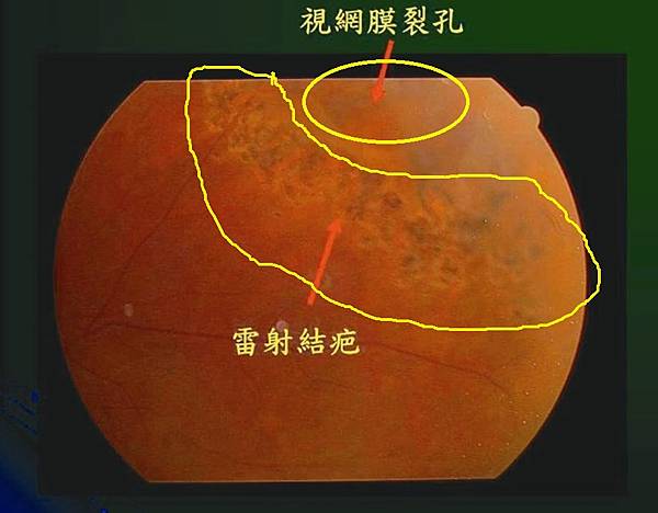 [問題]iPhone 16 pro當手機，I pad mini 6 當螢幕 ？