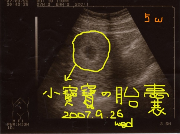 黃寶貝驗孕圖5週.jpg