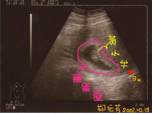 鄭傳芳9週061.jpg