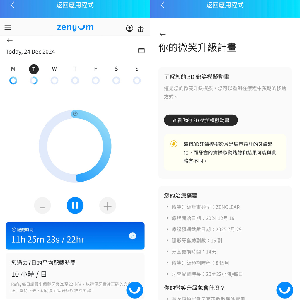 〈牙套分享〉【Zenyum綻雅】高CP值，可分期無負擔的隱形