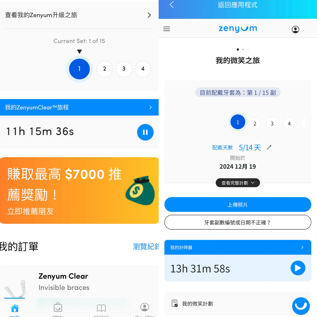 〈牙套分享〉【Zenyum綻雅】高CP值，可分期無負擔的隱形