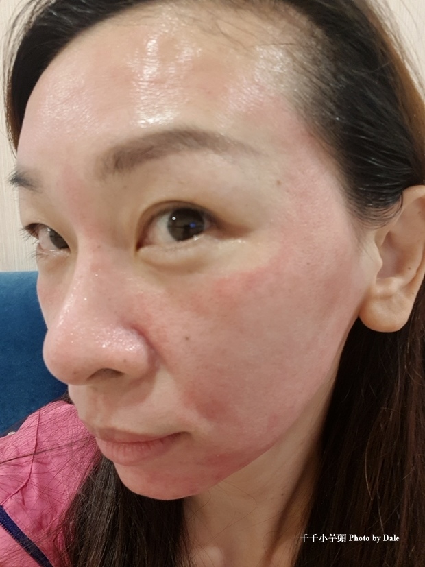淨妍皮秒14.jpg 淨妍皮秒14.jpg