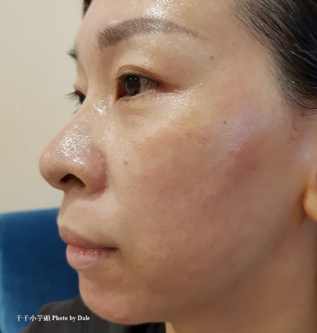 淨妍皮秒42.jpg 淨妍皮秒42.jpg