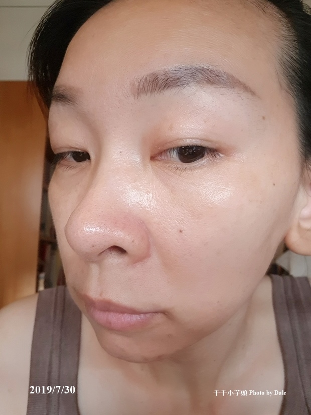 淨妍皮秒44.jpg 淨妍皮秒44.jpg