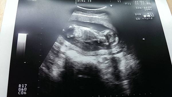 bebe15w+1