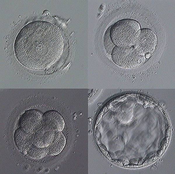 embryo.jpg embryo.jpg
