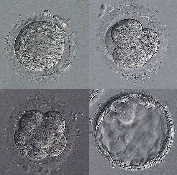 embryo.jpg