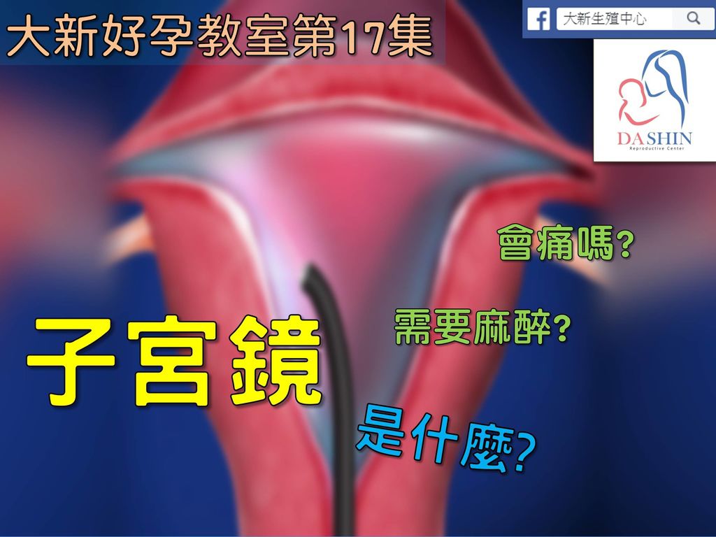 22.jpg 22.jpg