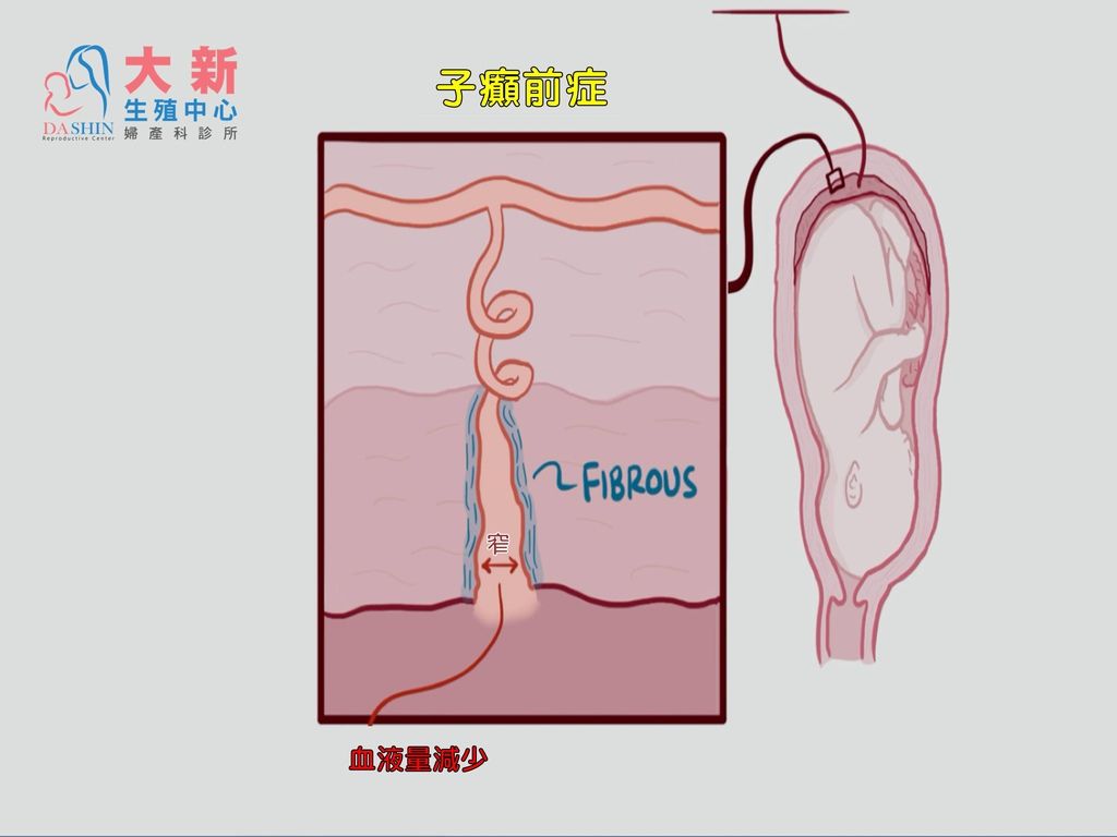 投影片4.JPG