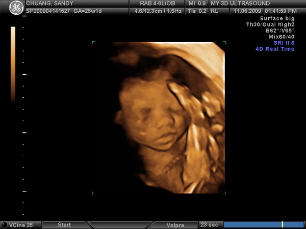 3DBABY_29.JPG 3DBABY_29.JPG