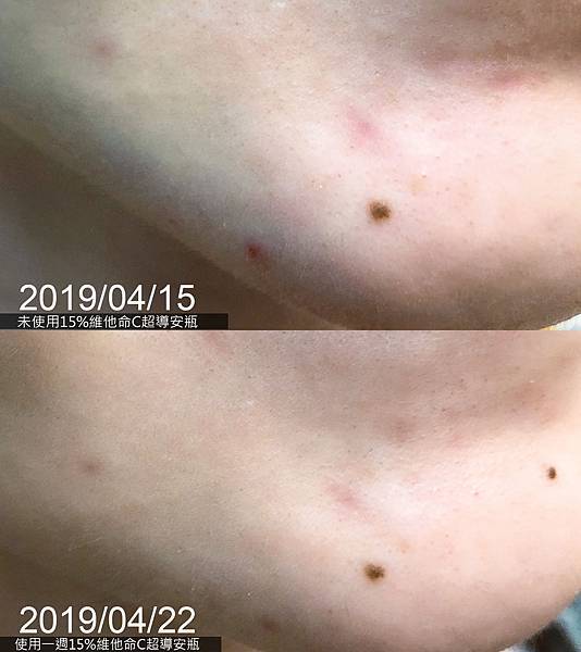 VICHY薇姿15%維他命C超導安瓶,安瓶推薦,維他命C,加強提亮