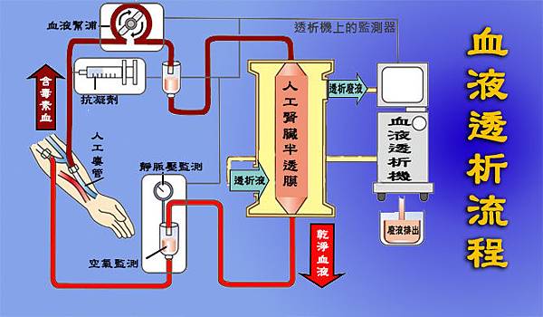 透析流程001.jpg