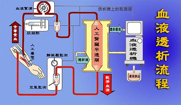 認識血液透析大業診所盧淑娟護理長 大業診所的衛教天地 痞客邦 認識血液透析大業診所盧淑娟護理長 大業診所的衛教天地 痞客邦