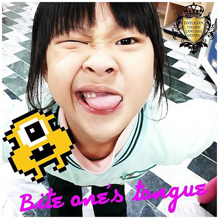 20170406 bite ones tongue.jpg 20170406 bite ones tongue.jpg