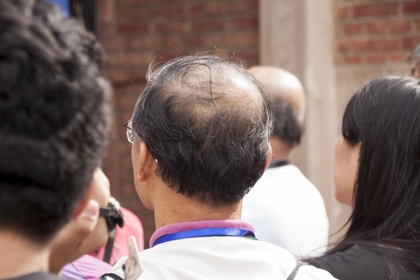 抹生薑生髮偏方 防禿頭切莫亂擦偏方.jpg 抹生薑生髮偏方 防禿頭切莫亂擦偏方.jpg