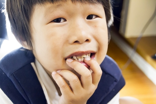 孩子咬指甲怎麼辦?.jpg 孩子咬指甲怎麼辦?.jpg